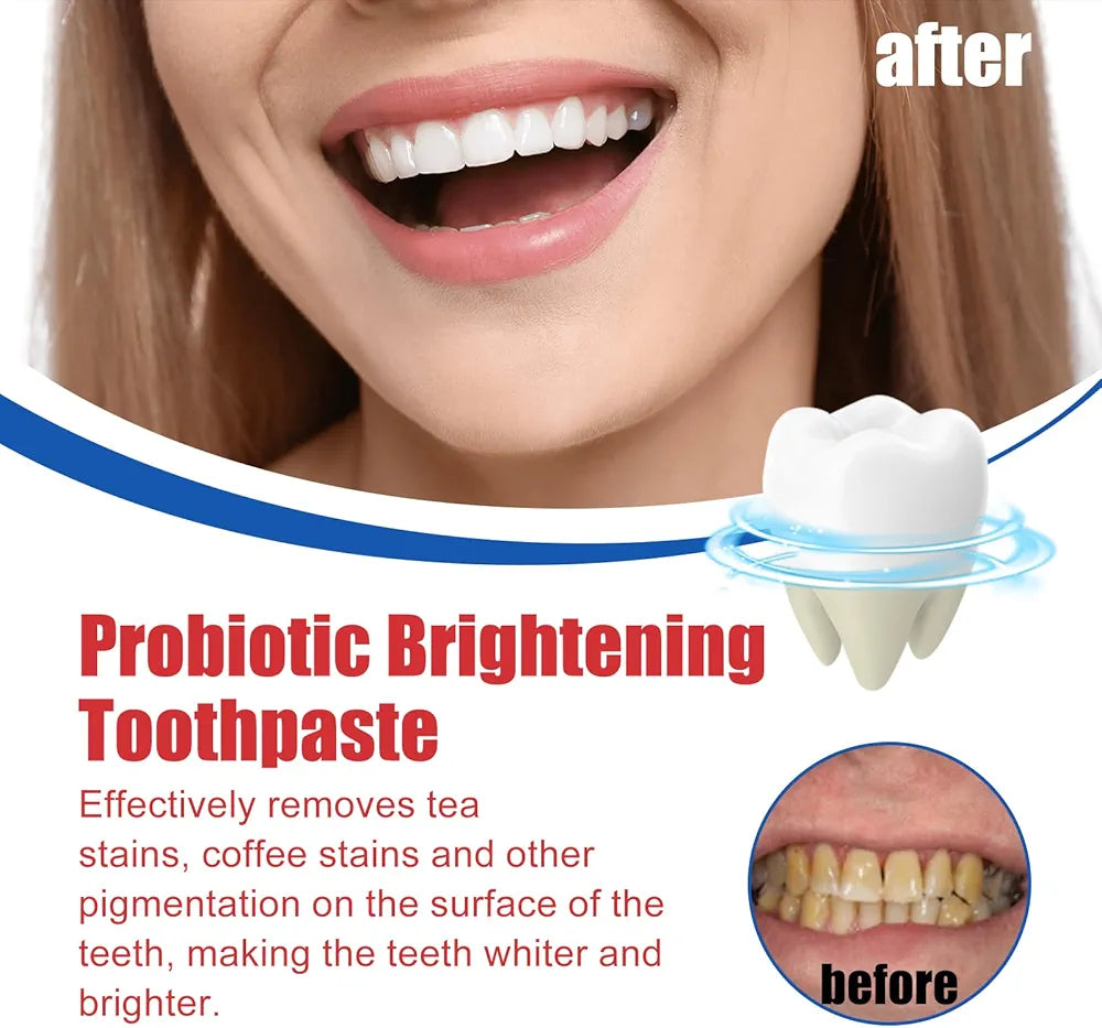 SP-6 Ultra Whitening Toothpaste– 120g (Original)