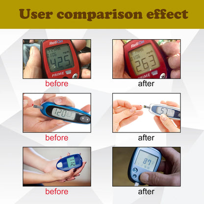 Sugar Control Wristband – Natural Support for Blood Sugar